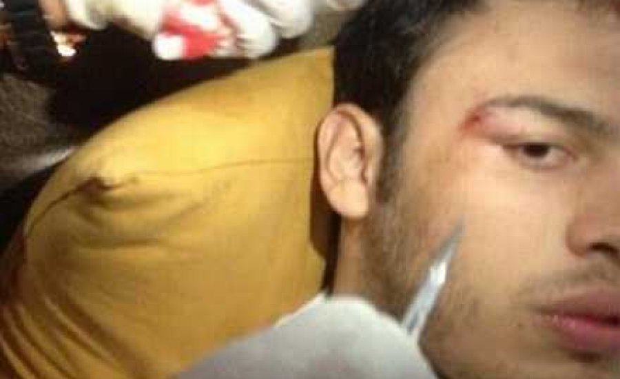 Elhalaszthatják Chavez Jr. visszatérését