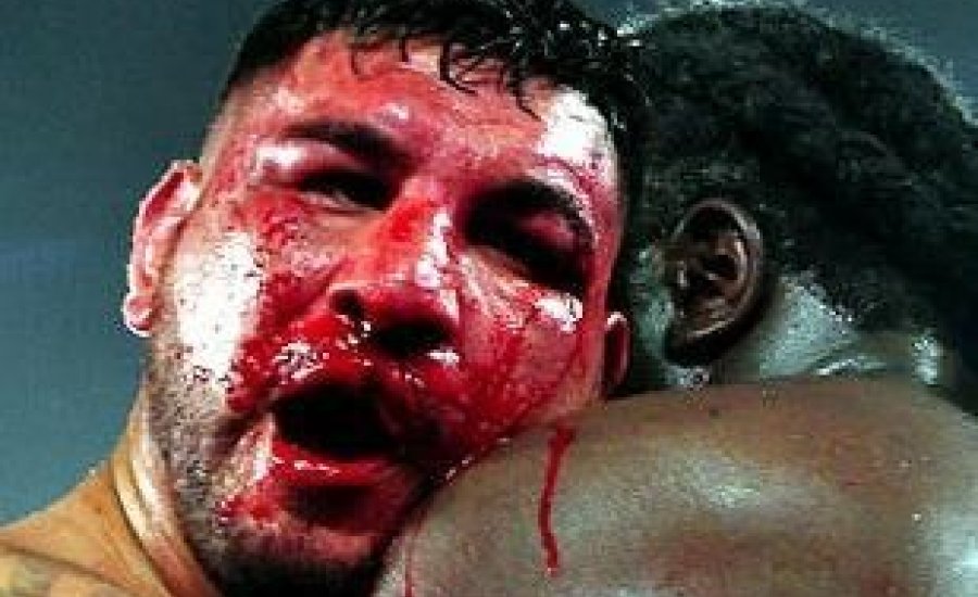 Megműtötték Chris Arreolát