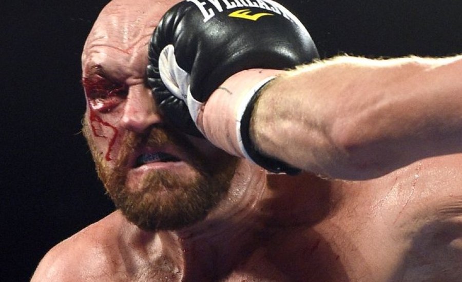 Tyson Fury apja nagyon kiakadt fia produkcióján