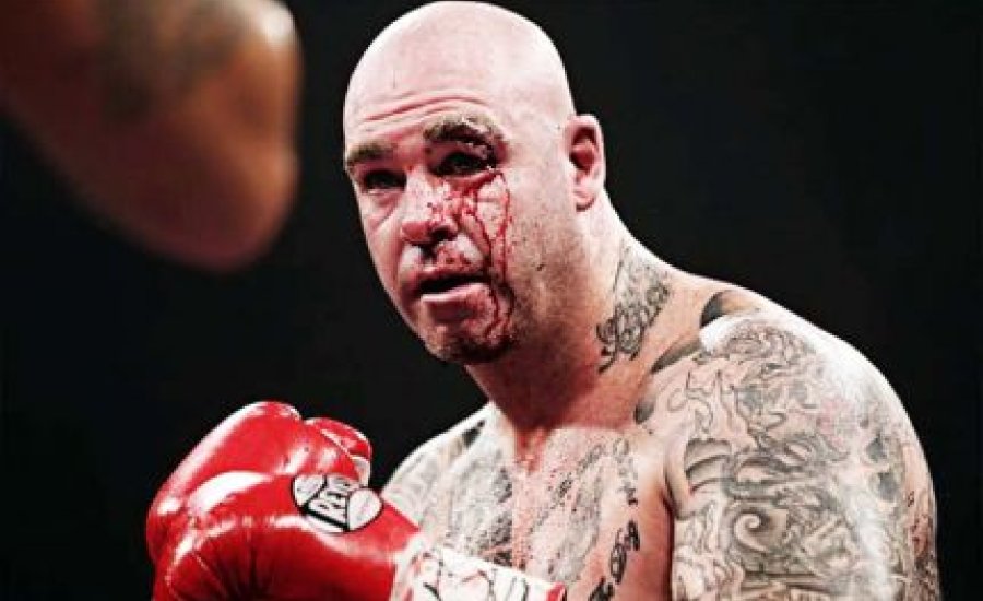 Lucas Browne doppingügye elég rejtélyes