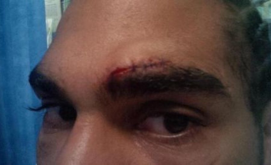 David Haye megsérült, csúszik a brit nehézsúlyú csúcsmeccs