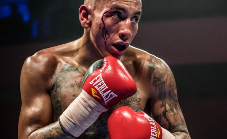 Csak egyszer kell telibeverni Amir Khan állát