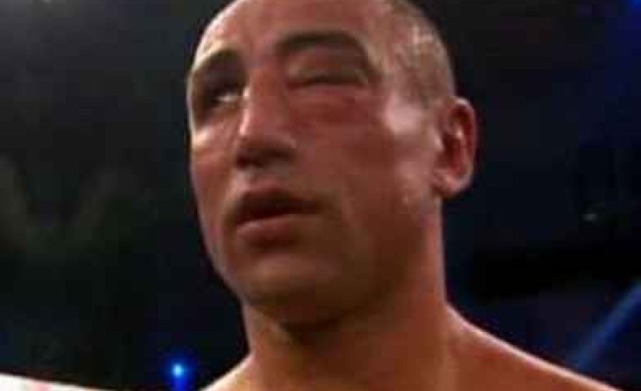 Abraham szeme rendben