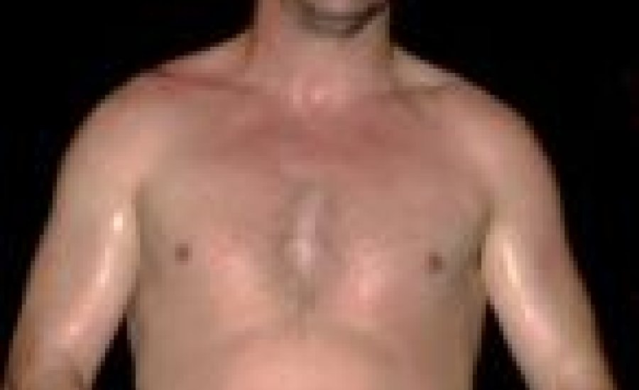 „Hóhér” keze csak két menetet bírt Frenkel ellen