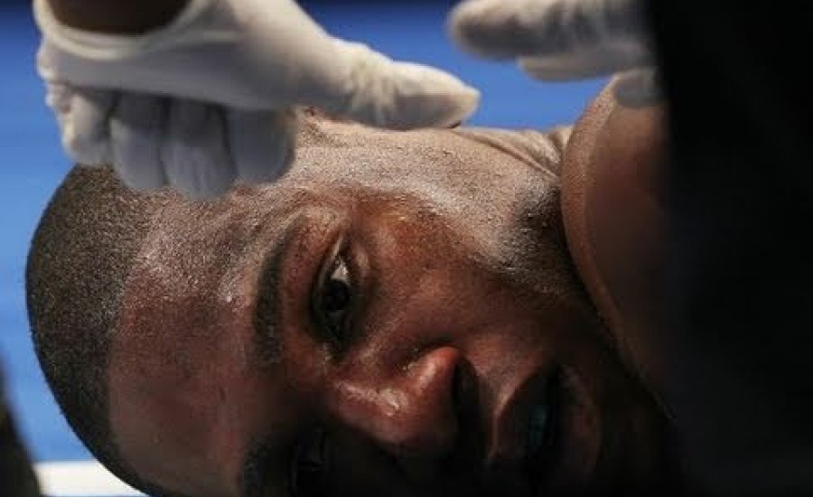 20 brutális egy ütéses profibox KO