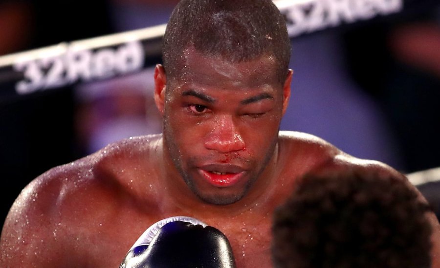 A „Dinamit” is interim vb-címmérkőzésen térhet vissza