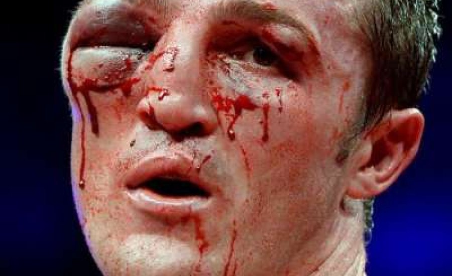 Lebegyev azonnali visszavágót kér