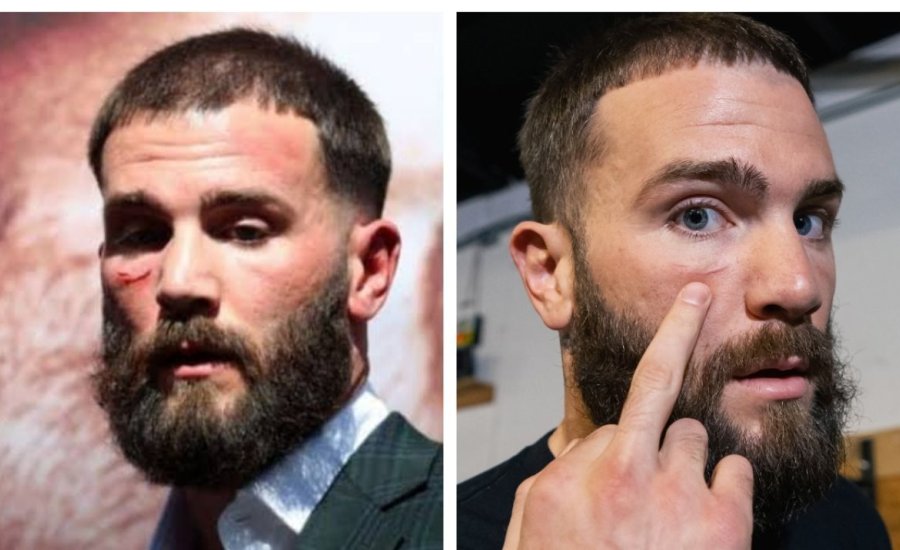 Caleb Plant alig várja, hogy elkezdődjön a „Canelo” elleni harc