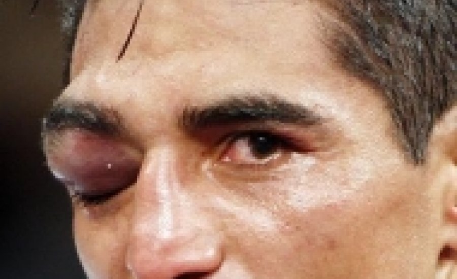 Morales már nem akar visszavágót Maidana ellen