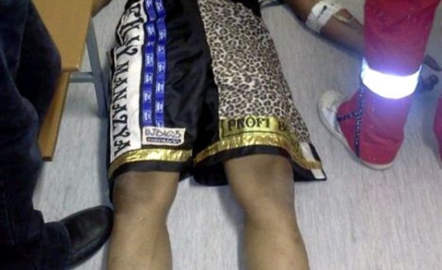 Srác a trópusokról, egyedülálló képességekkel