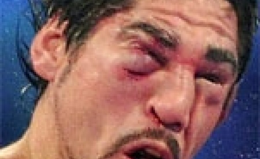 Műteni kell az összevert Margaritót