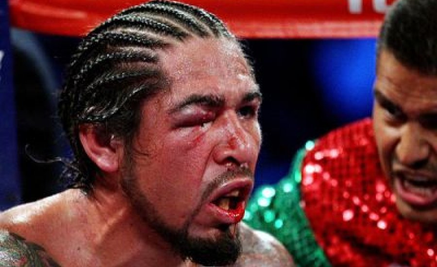 Antonio Margarito visszatérhet