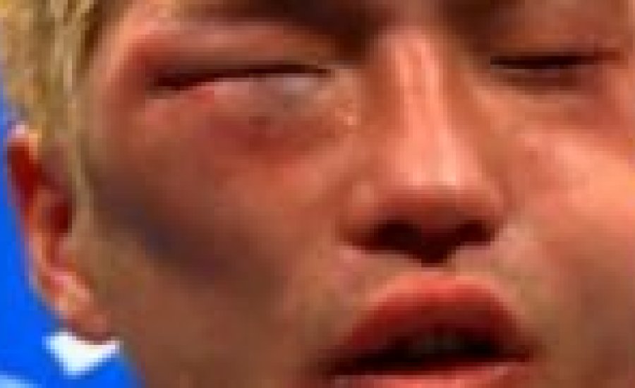 Rigondeaux vs Amagasa