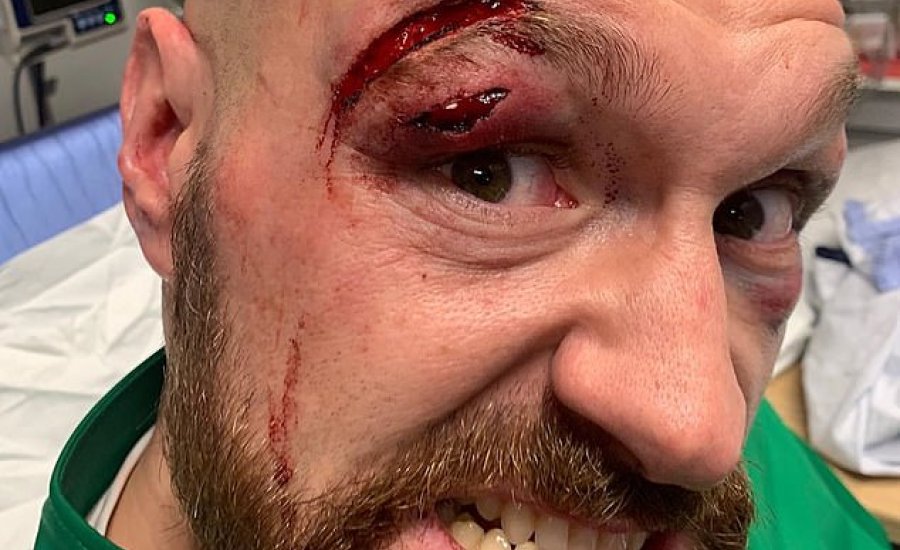 Nem lehet februárban a Wilder-Fury visszavágó?