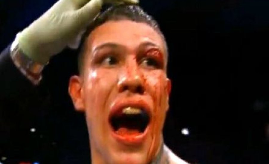 Peter Quillin megvédte középsúlyú WBO vb-övét