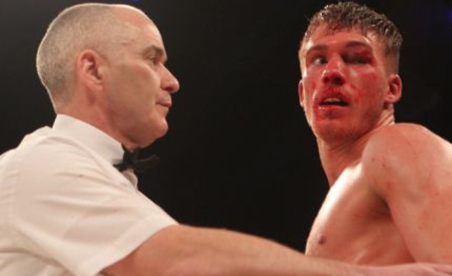 Blackwell túl az életveszélyen