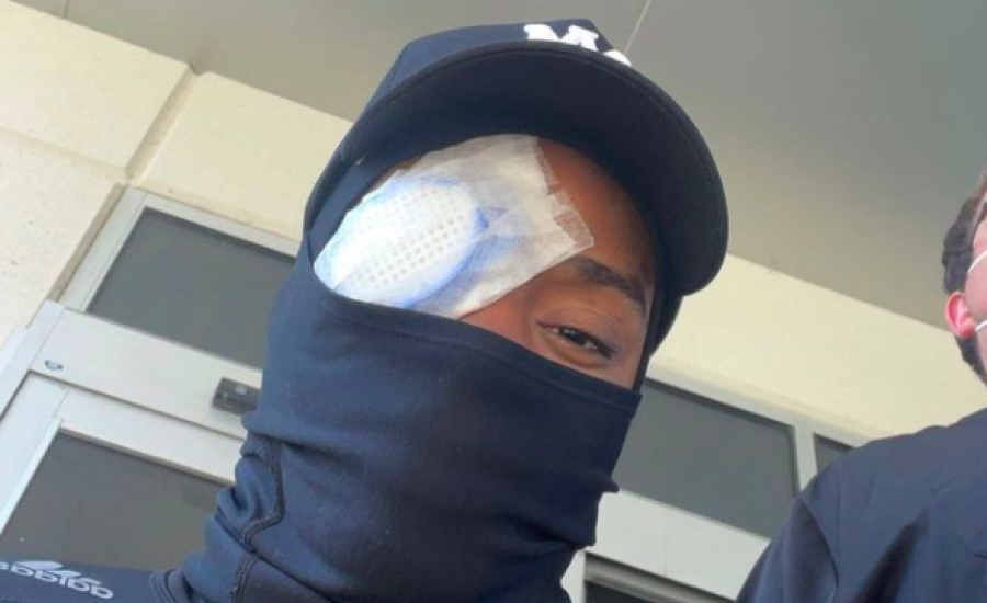 Megműtötték Errol Spence Jr-t